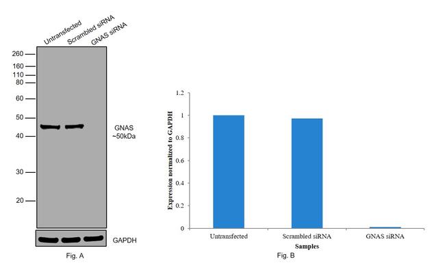 GNAS Antibody in Western Blot (WB)