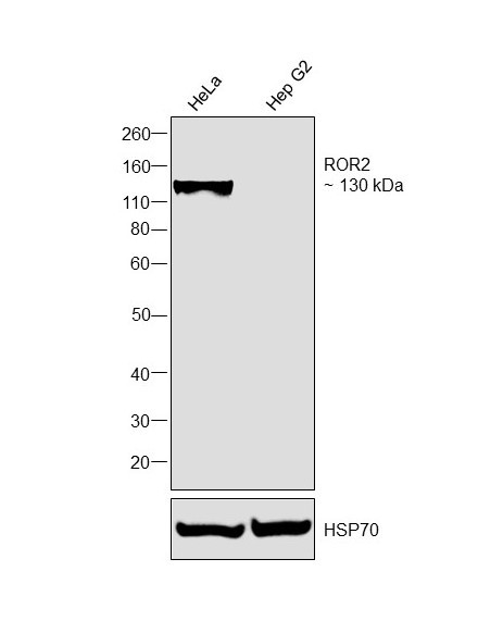 ROR2 Antibody