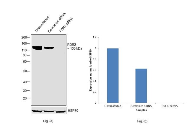 ROR2 Antibody in Western Blot (WB)