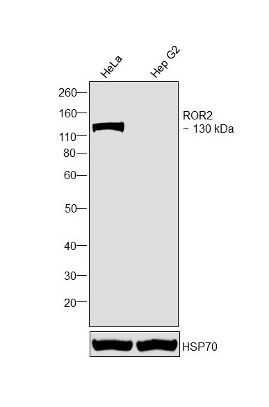 ROR2 Antibody