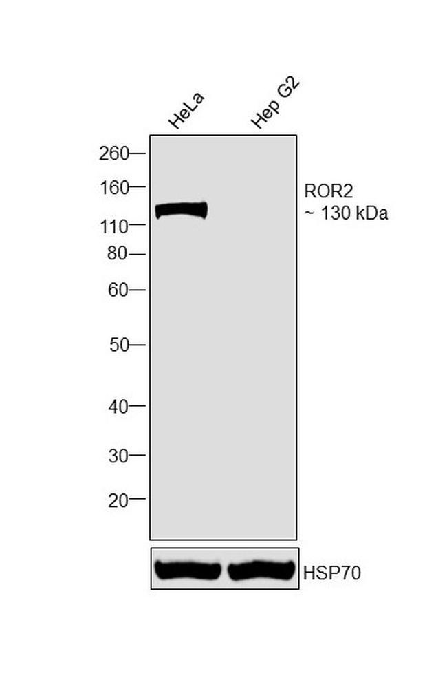 ROR2 Antibody in Western Blot (WB)