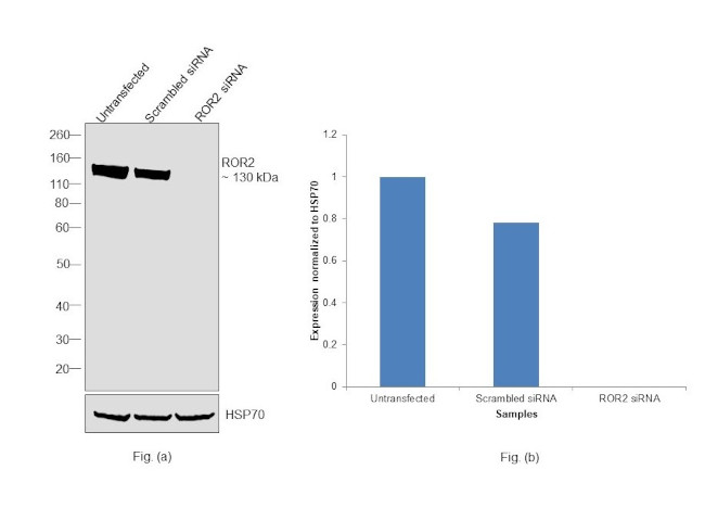 ROR2 Antibody