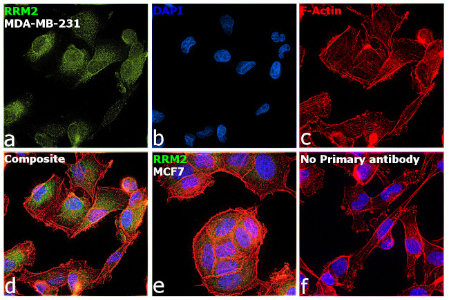 RRM2 Antibody in Immunocytochemistry (ICC/IF)