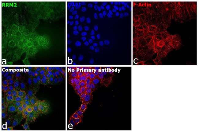 RRM2 Antibody in Immunocytochemistry (ICC/IF)