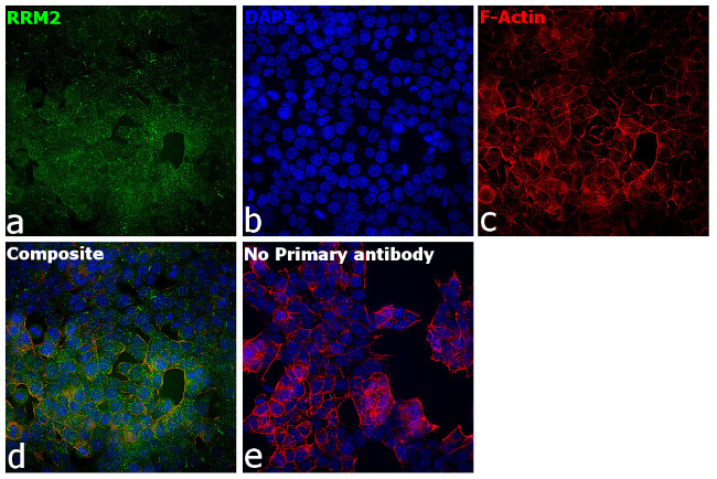 RRM2 Antibody in Immunocytochemistry (ICC/IF)
