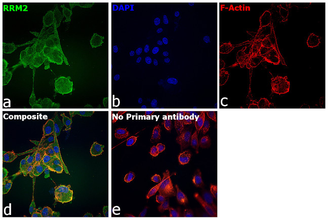 RRM2 Antibody in Immunocytochemistry (ICC/IF)