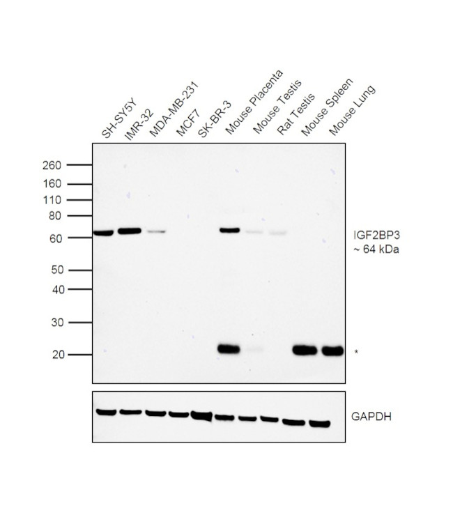 IGF2BP3 Antibody