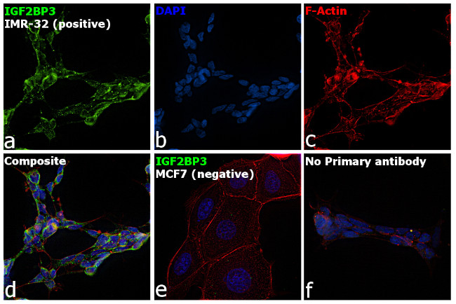 IGF2BP3 Antibody in Immunocytochemistry (ICC/IF)