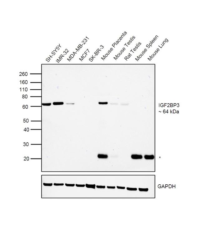 IGF2BP3 Antibody in Western Blot (WB)