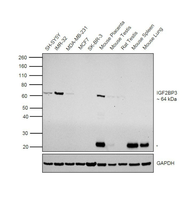 IGF2BP3 Antibody