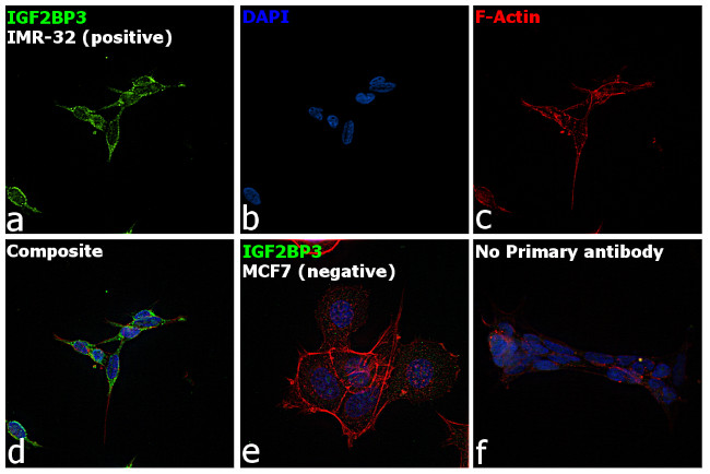 IGF2BP3 Antibody in Immunocytochemistry (ICC/IF)