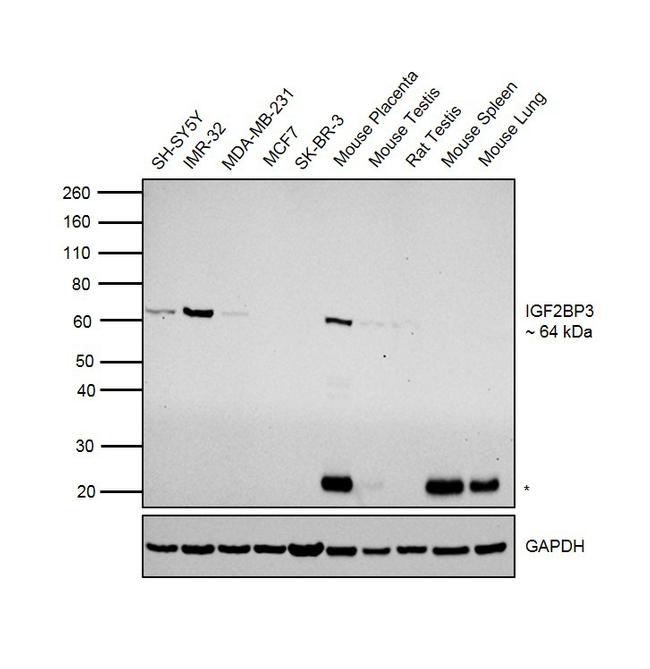 IGF2BP3 Antibody in Western Blot (WB)