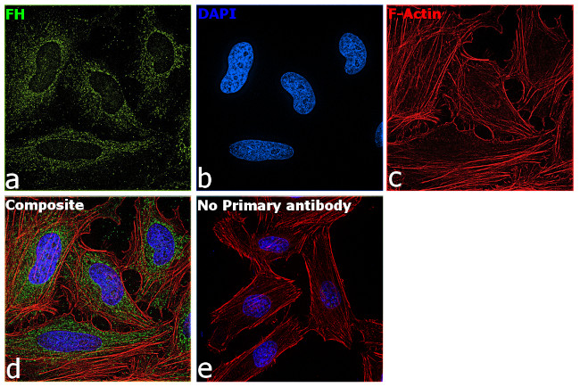 Fumarase Antibody in Immunocytochemistry (ICC/IF)