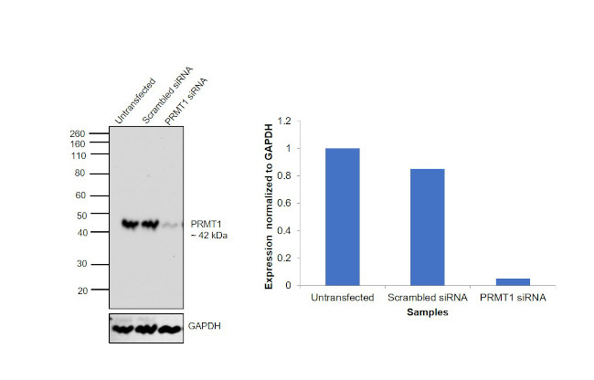 PRMT1 Antibody