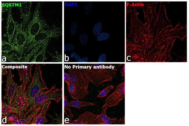 SQSTM1 Antibody in Immunocytochemistry (ICC/IF)