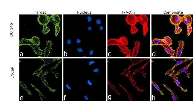 Alpha Actinin 4 Antibody