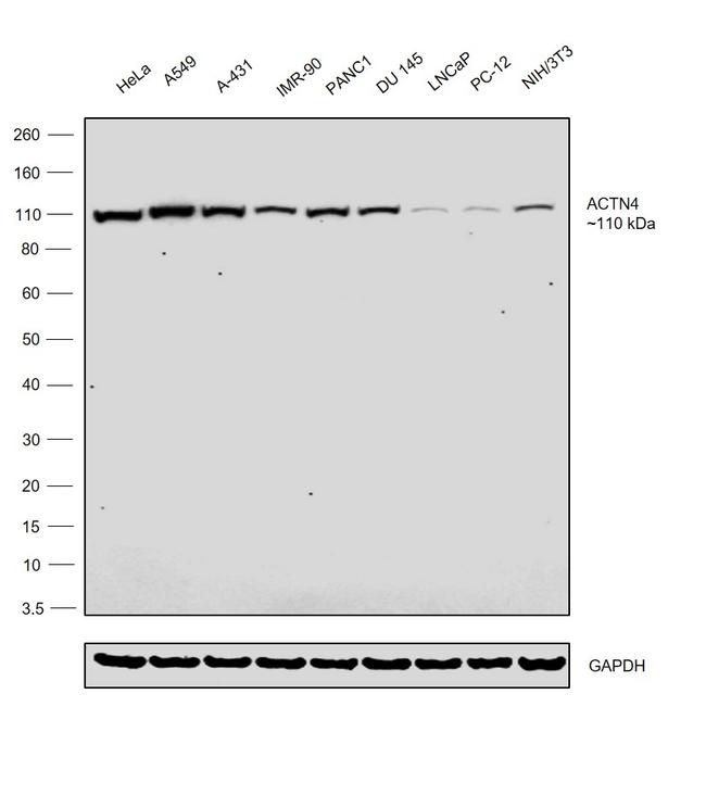 Alpha Actinin 4 Antibody in Western Blot (WB)