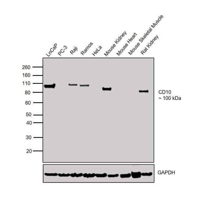 CD10 Antibody in Western Blot (WB)