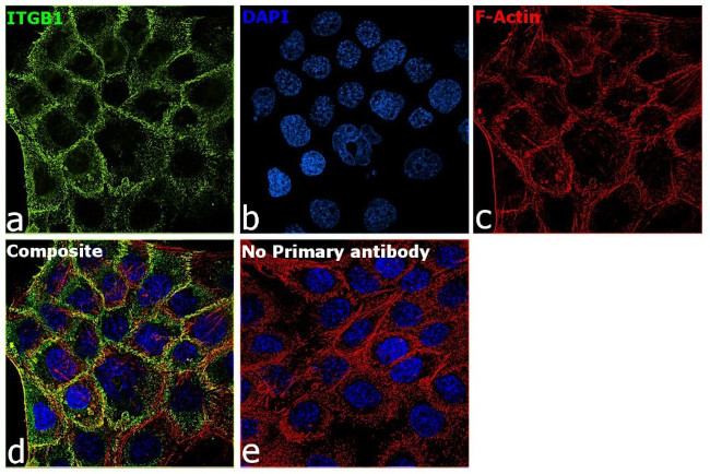 Integrin beta 1 (CD29) Antibody in Immunocytochemistry (ICC/IF)