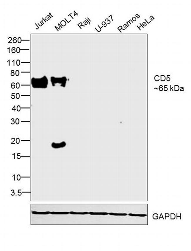 CD5 Antibody in Western Blot (WB)