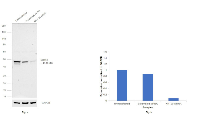 Cytokeratin 20 Antibody