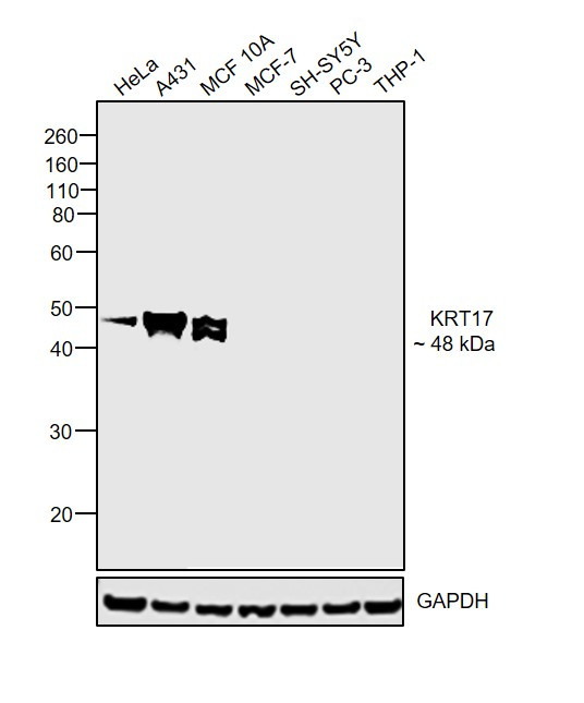 Cytokeratin 17 Antibody