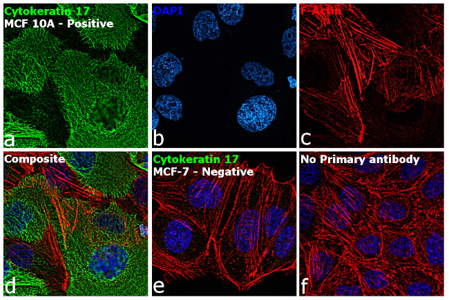 Cytokeratin 17 Antibody in Immunocytochemistry (ICC/IF)