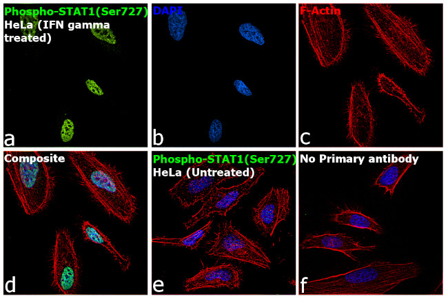 Phospho-Stat1 (Ser727) Antibody