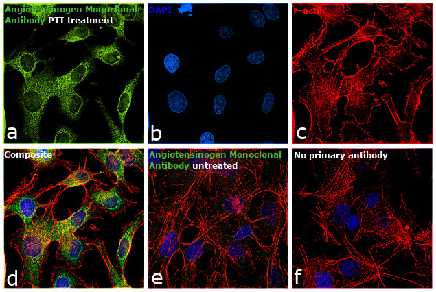 Angiotensinogen Antibody in Immunocytochemistry (ICC/IF)