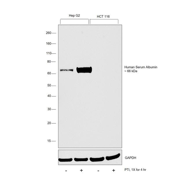 Human Serum Albumin Antibody in Western Blot (WB)