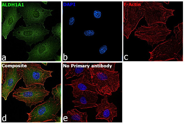 ALDH1A1 Antibody in Immunocytochemistry (ICC/IF)