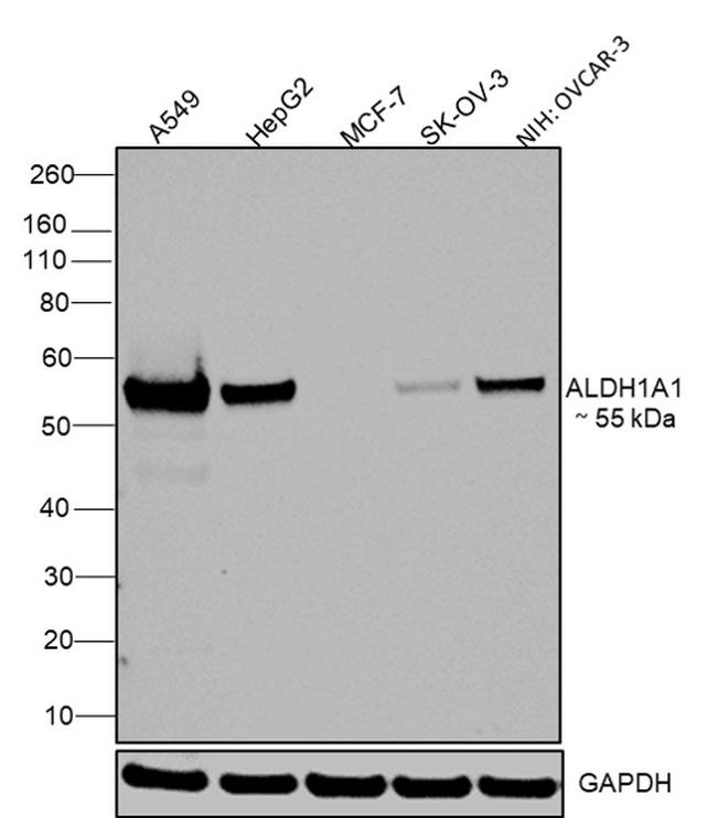 ALDH1A1 Antibody in Western Blot (WB)