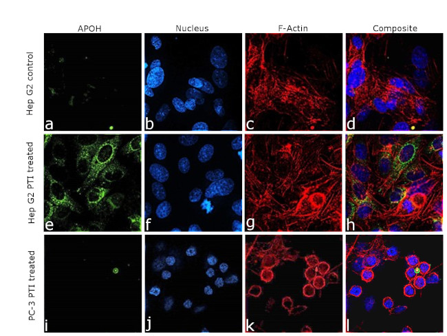 Apolipoprotein H Antibody