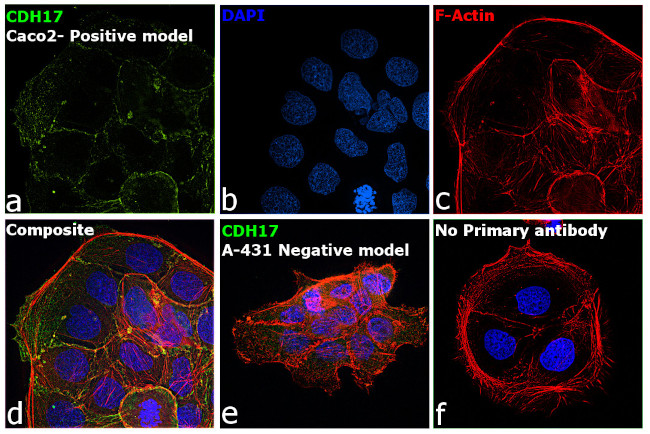 CDH17 Antibody in Immunocytochemistry (ICC/IF)