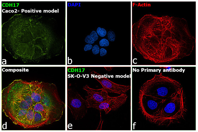 CDH17 Antibody in Immunocytochemistry (ICC/IF)