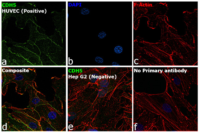 VE-cadherin Antibody in Immunocytochemistry (ICC/IF)