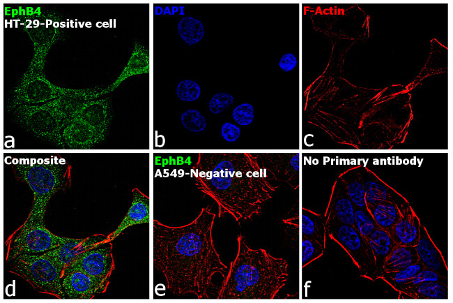 EphB4 Antibody in Immunocytochemistry (ICC/IF)