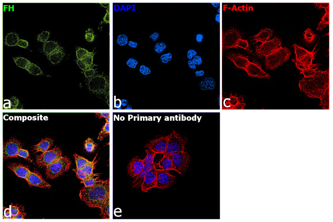 Fumarase Antibody in Immunocytochemistry (ICC/IF)