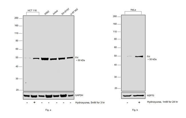 Fumarase Antibody in Western Blot (WB)