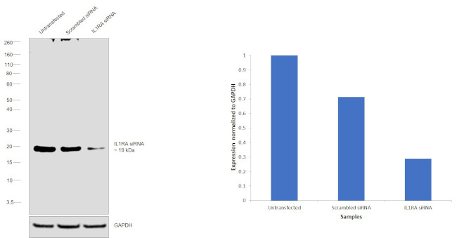 IL1RA Antibody