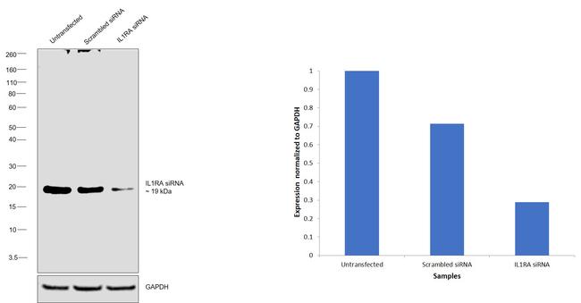 IL1RA Antibody in Western Blot (WB)