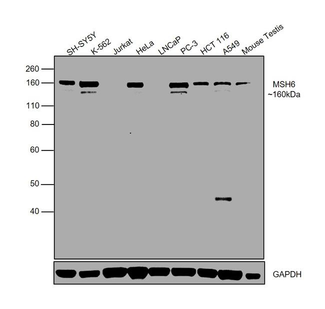 MSH6 Antibody in Western Blot (WB)