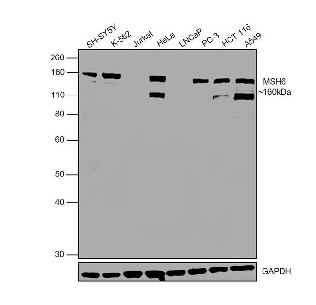 MSH6 Antibody in Western Blot (WB)