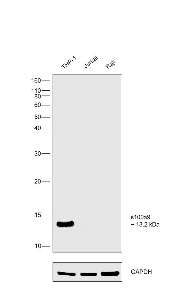 S100A9 Antibody in Western Blot (WB)