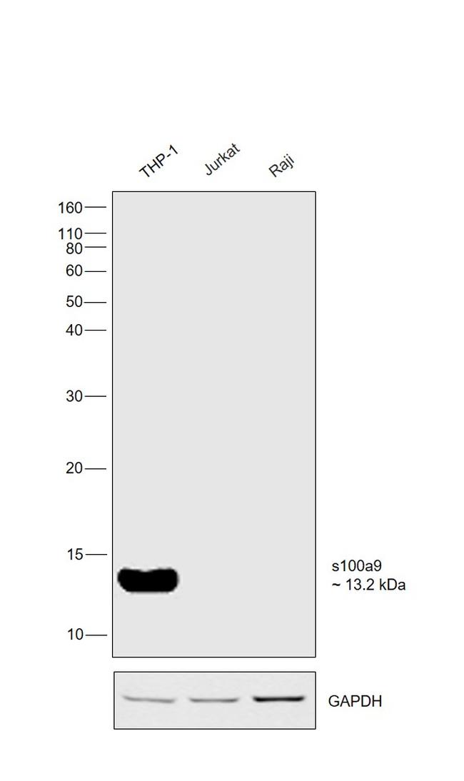 S100A9 Antibody in Western Blot (WB)