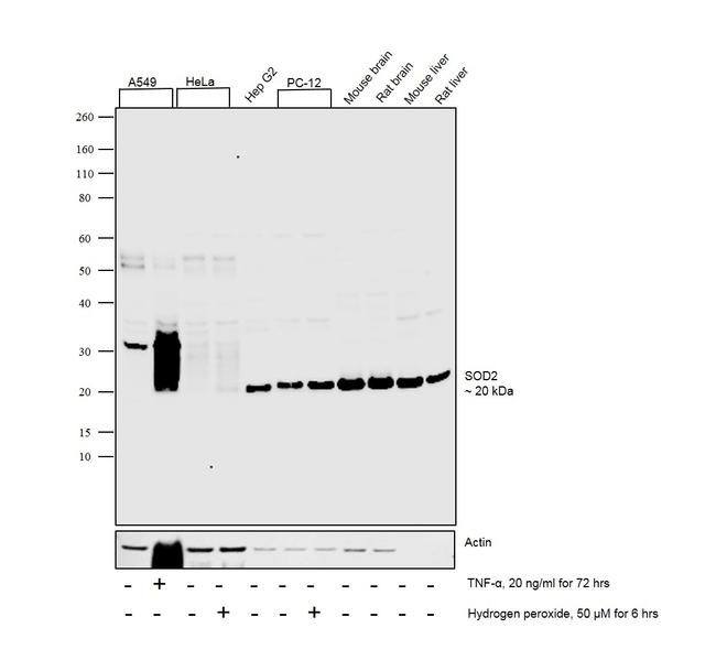 SOD2 Antibody in Western Blot (WB)