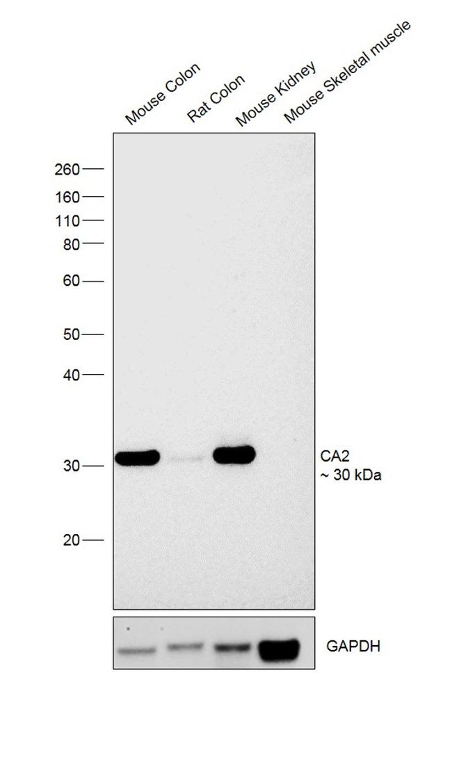 Carbonic Anhydrase II Antibody in Western Blot (WB)