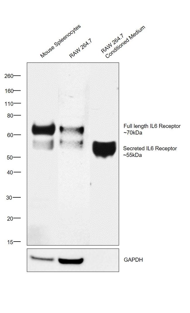 IL-6 Receptor Antibody in Western Blot (WB)