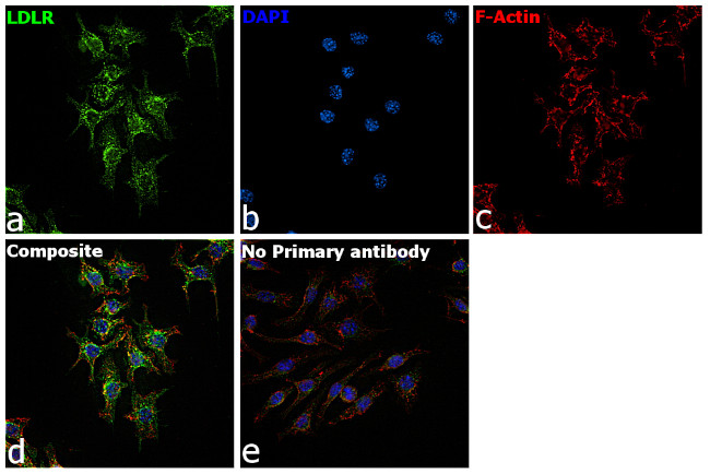 LDLR Antibody in Immunocytochemistry (ICC/IF)