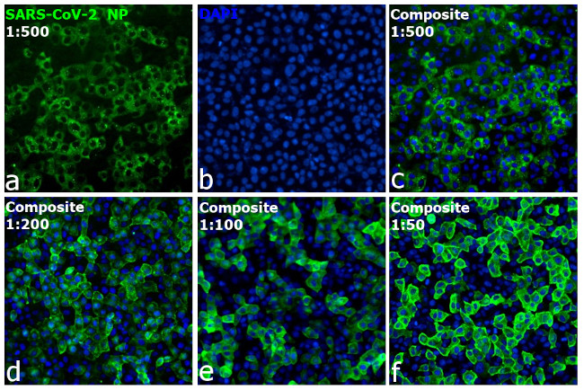 SARS/SARS-CoV-2 Nucleocapsid Antibody in Immunocytochemistry (ICC/IF)